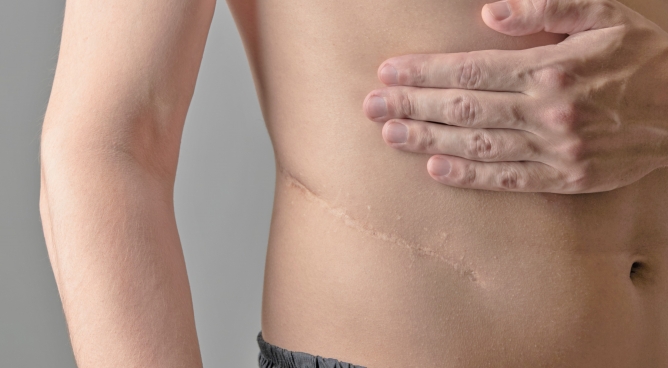 Narben und ihre therapeutische Bedeutung